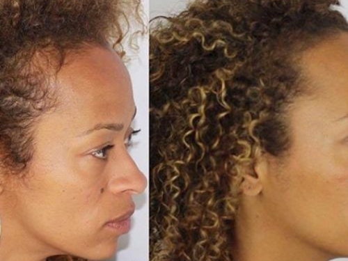 micropigmentation cheveux femme