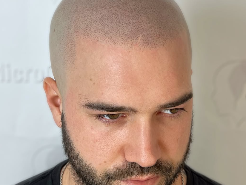 Comment bien choisir son technicien en micropigmentation