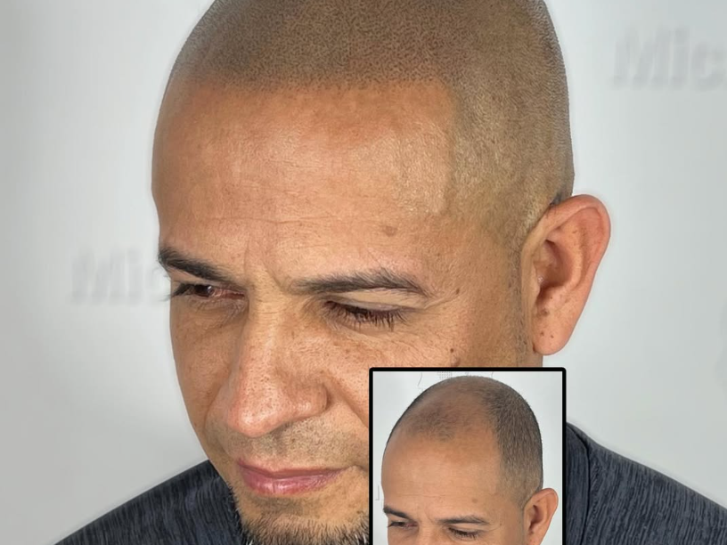 Bien-être et micropigmentation