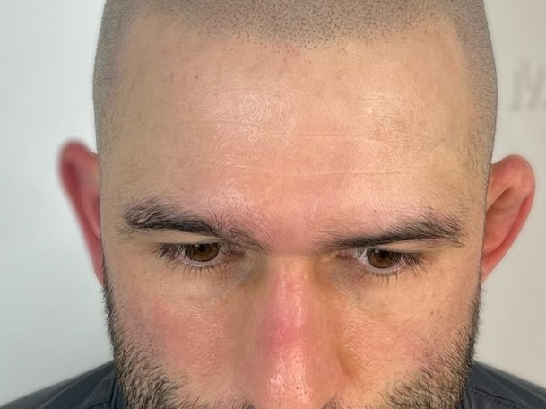Micropigmentation vs Tatouage traditionnel : Quelle est la vraie différence ?
